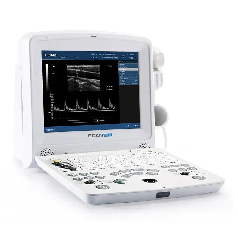 Фото УЗИ аппарат Edan Dus 60