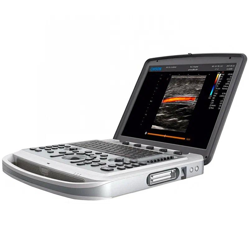 Фото УЗИ аппарат Chison SonoTouch 80Exp