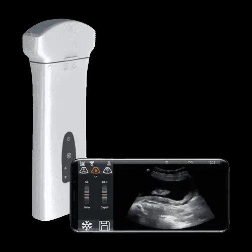 Фото DELTA D8 портативная УЗ-система