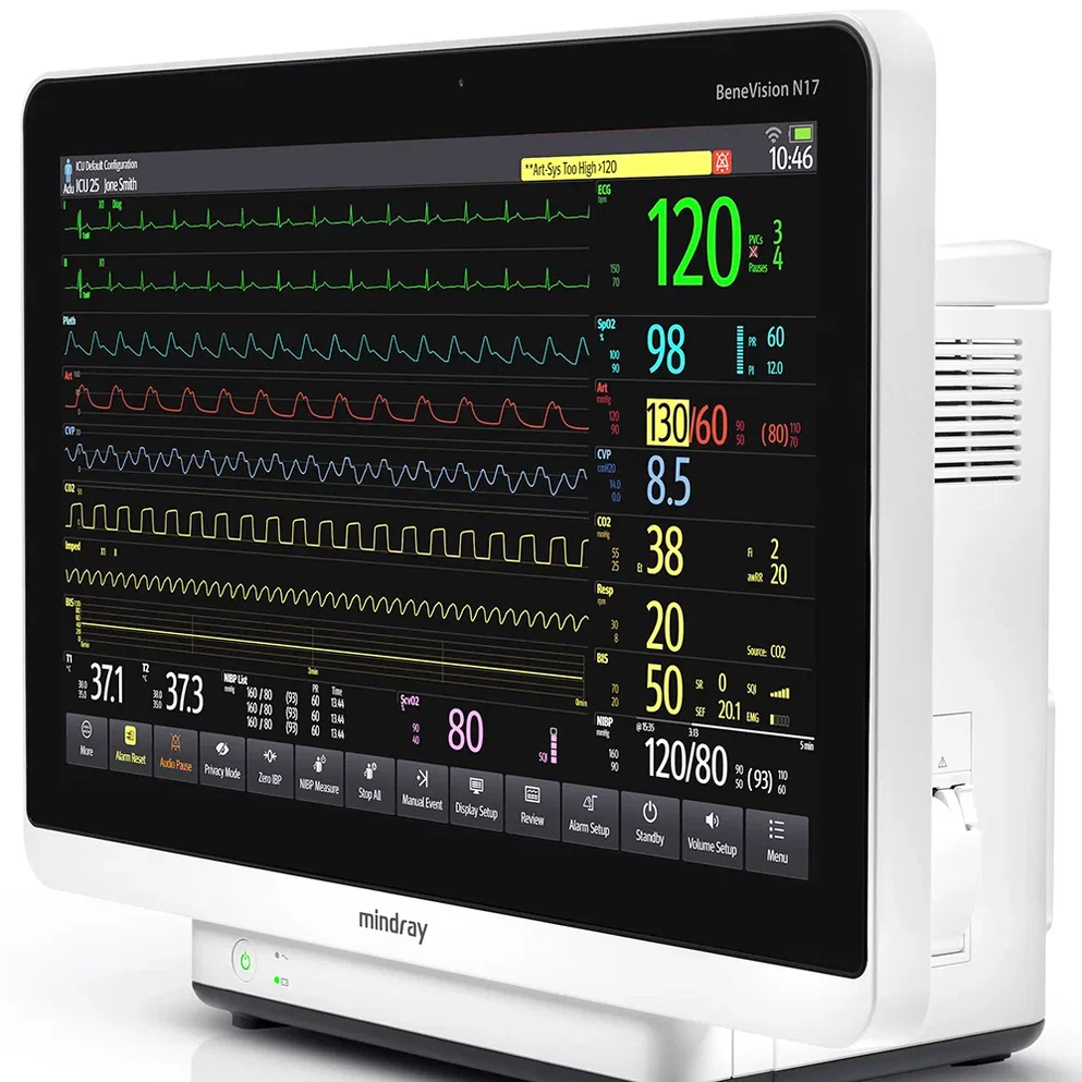 Mindray BeneVision N12, N15 ,N17 монитор пациента купить в Москве и  Московской области, Россия и Республика Беларусь.