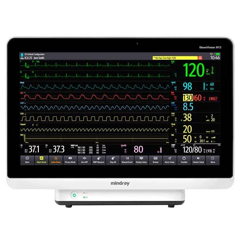 Фото монитора пациента